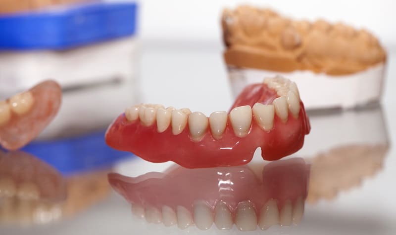 Prótesis Dentales: Solución para Reemplazar Dientes Perdidos