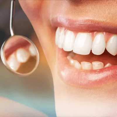 Bruxismo en CDMX: impacto en la salud dental y sus principales causas