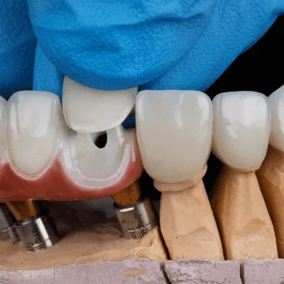 ¿Qué médico trata los problemas dentales infantiles?